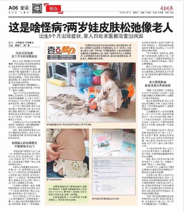 这是啥怪病？两岁娃皮肤松弛像老人，聊城幼儿家长向全国求医